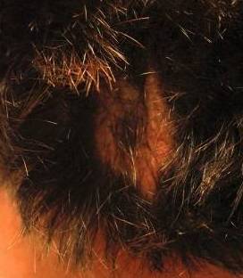 Hair Loss Before and After Case 3 After