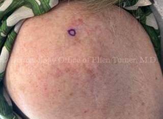 SRT-100 Before and After Case-89 Before