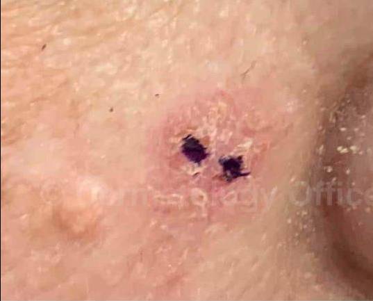 SRT-100 Before and After Case 2 Before