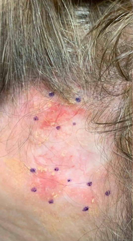 SRT-100 Before and After Case 73 Before