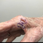 SRT-100 Radiation Before and After Case 27 Before