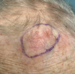 SRT-100 Radiation Before and After Case-109 Before