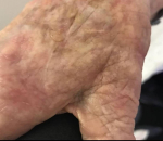 SRT-100 Radiation Before and After Case 27 After