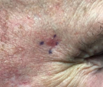SRT-100 Radiation Before and After Case 94 After