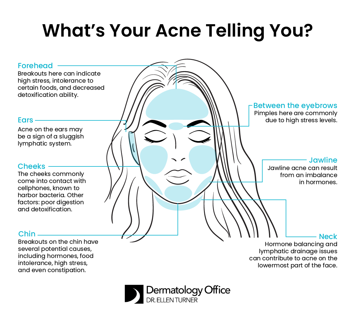 Learn the causes of facial acne from the Dallas area’s Dr. Ellen Turner.
