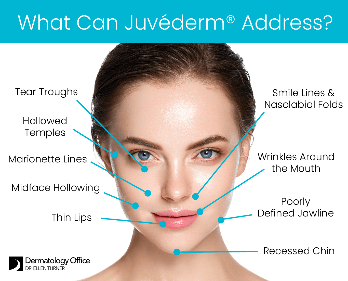 Learn what’s possible with Juvéderm® at Dallas and Irving’s Dermatology Office.