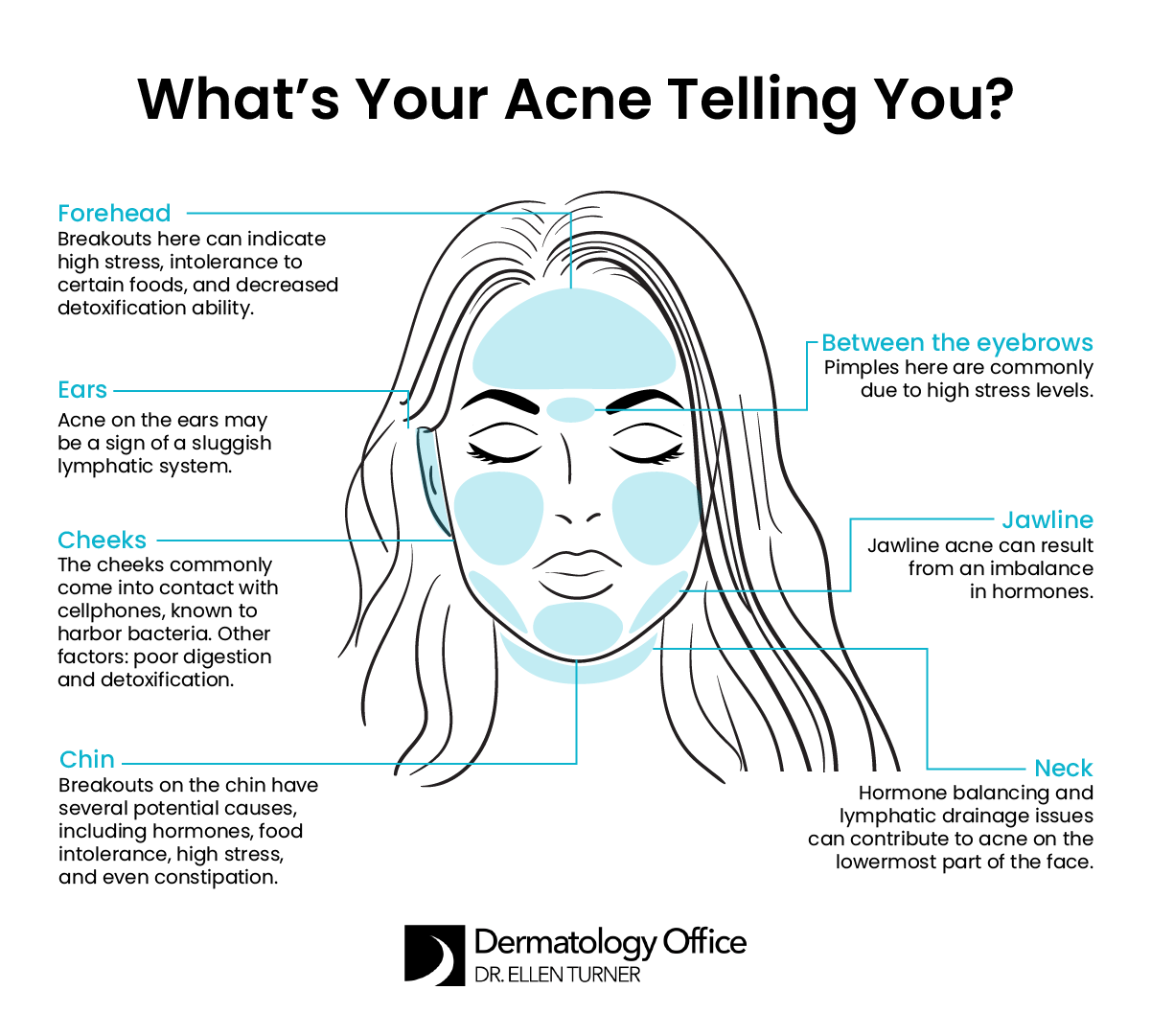 What's Your Acne Telling You?