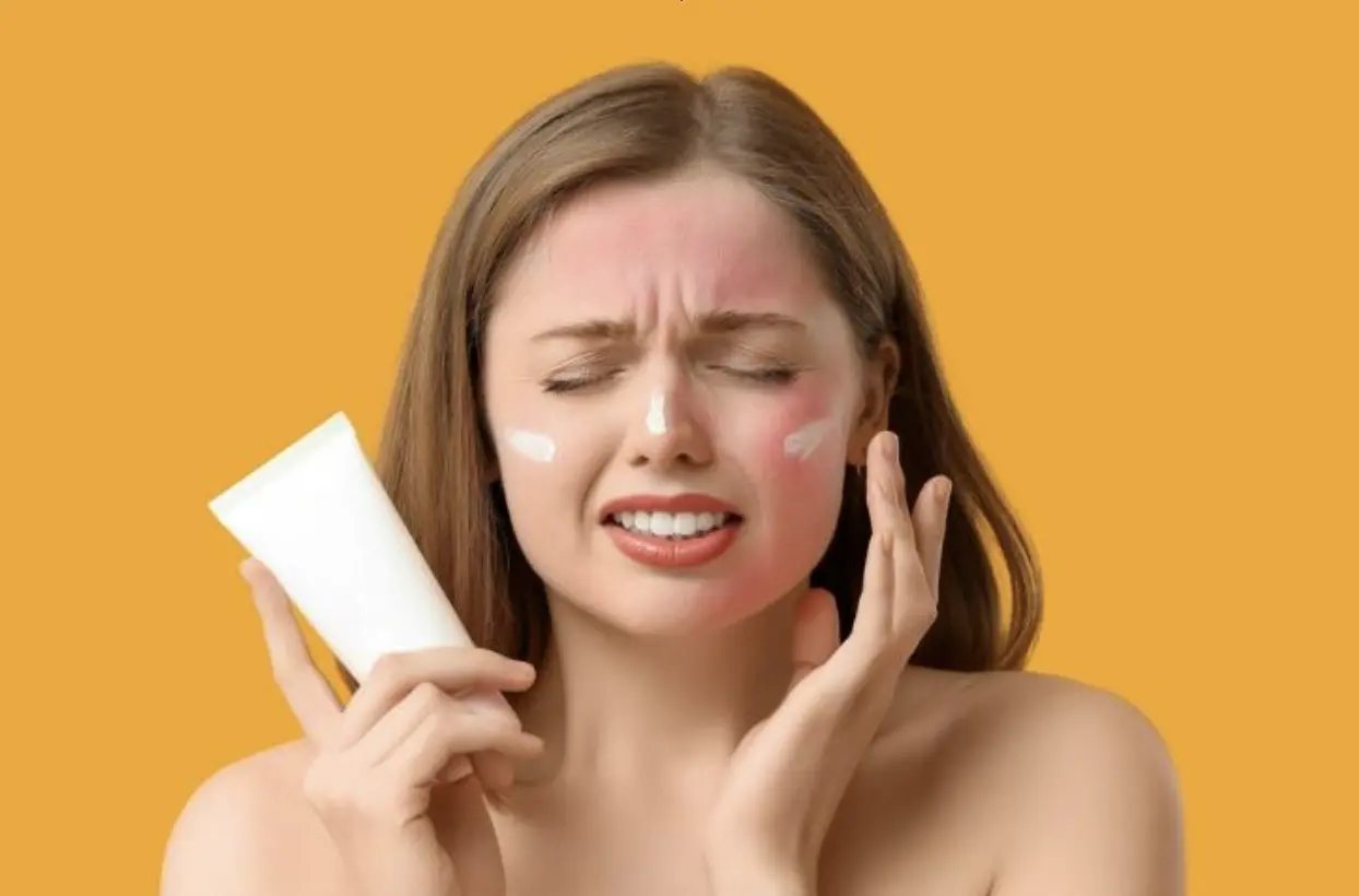 Sunburn warning signs and skin care