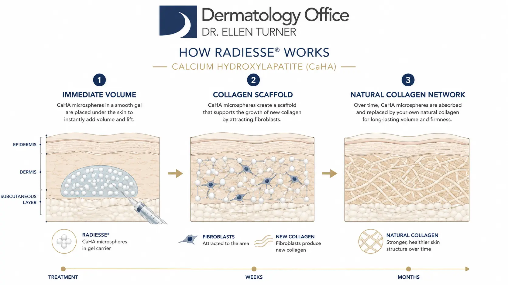 How Radiesse works: calcium hydroxylapatite three-stage mechanism diagram