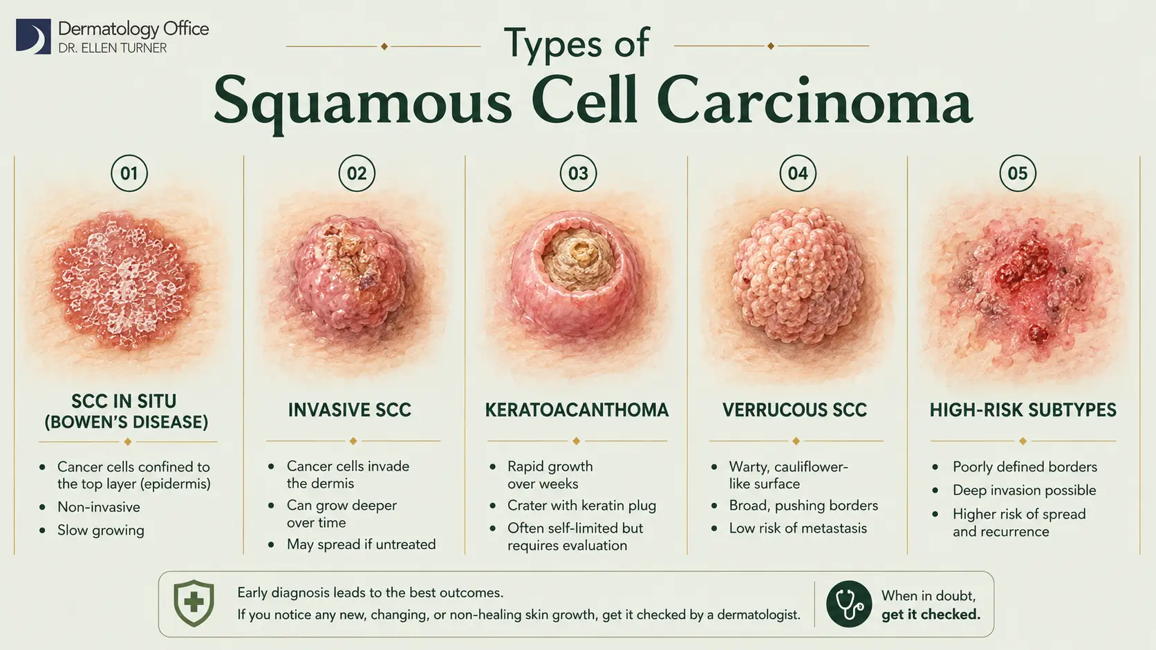 Five subtypes of squamous cell carcinoma: in situ, invasive, keratoacanthoma, verrucous, and high-risk